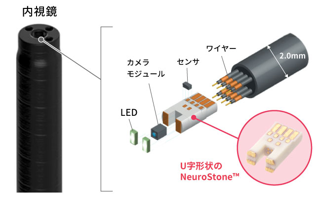 内視鏡でのNeuroStone™の使用イメージ
