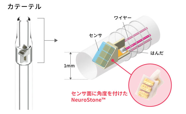 カテーテルでのNeuroStone™の使われ方
